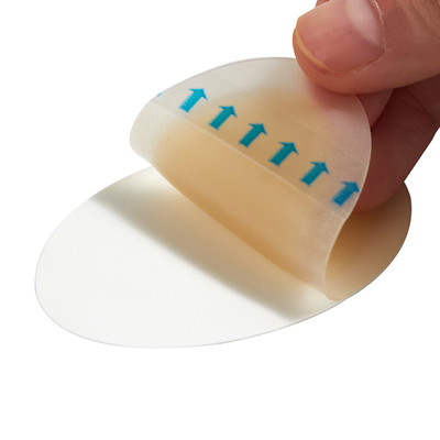 Hydrocolloid Blister Plaster